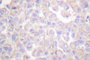 Image no. 1 for anti-Claudin 2 (CLDN2) antibody (ABIN265361) (Claudin 2 Antikörper)