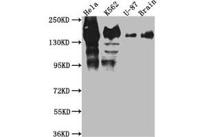 Western Blot Positive WB detected in: Hela whole cell lysate, K562 whole cell lysate, U-87 whole cell lysate, Mouse Brain whole cell lysate All lanes: SF3B1 antibody at 1:1000 Secondary Goat polyclonal to rabbit IgG at 1/50000 dilution Predicted band size: 146, 17 kDa Observed band size: 130 kDa (Rekombinanter SF3B1 Antikörper)