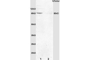 Formalin-fixed and paraffin embedded mouse embryo labeled with Anti-p95 NBS1/Cell cycle regulatory protein p95 Polyclonal Antibody, Unconjugated (ABIN762776) at 1:200 followed by conjugation to the secondary antibody and DAB staining. (Nibrin Antikörper  (AA 641-754))