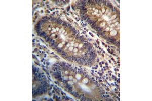 PG Antibody (Center) (ABIN657161 and ABIN2846295) immunohistochemistry analysis in formalin fixed and paraffin embedded human colon tissue followed by peroxidase conjugation of the secondary antibody and DAB staining. (PGAP3 Antikörper  (AA 141-169))