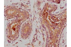 Immunohistochemistry (IHC) image for anti-Matrix Metallopeptidase 9 (Gelatinase B, 92kDa Gelatinase, 92kDa Type IV Collagenase) (MMP9) antibody (ABIN7127625)