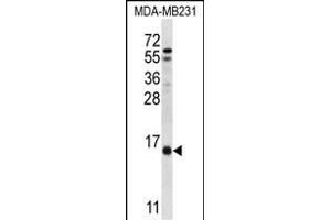 HINT3 Antibody (N-term) (ABIN657020 and ABIN2846199) western blot analysis in MDA-M cell line lysates (35 μg/lane). (HINT3 Antikörper  (N-Term))