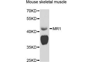 Western blot analysis of extracts of mouse skeletal muscle, using MR1 antibody (ABIN5974481) at 1/1000 dilution.