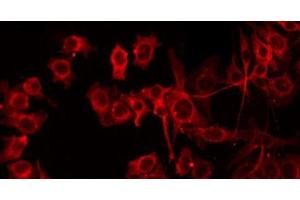 ABIN6279645 staining HepG2 by IF/ICC. (CROT Antikörper  (Internal Region))