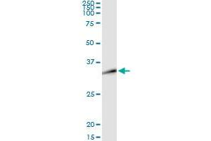 DLX1 (Human) IP-WB Antibody Pair