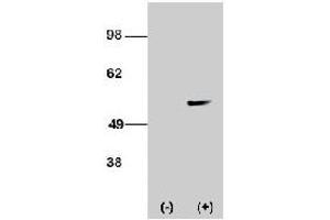 Western blot analysis of STK38L polyclonal antibody  transiently transfected HEK-293 cell line lysate (1 ug/lane).