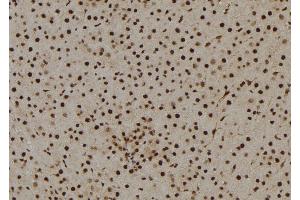 ABIN6261142 and ABIN6269146 at 1/100 staining Rat liver tissue by IHC-P.