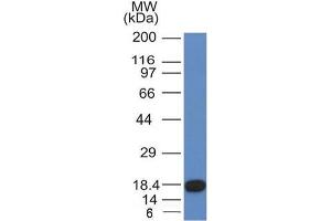 Western Blot Analysis of recombinant fragment of CD117 with CD117 Mouse Monoclonal Antibody (KIT/982).