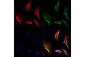 ABIN6262864 and ABIN6277023 staining Hela cells by IF/ICC.