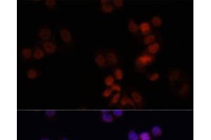 Immunofluorescence analysis of HCT116 cells using KDM7A Polyclonal Antibody at dilution of 1:150. (JHDM1D Antikörper)