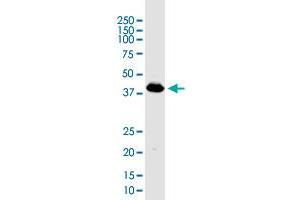 Western Blotting (WB) image for anti-Pyruvate Dehydrogenase (Lipoamide) alpha 1 (PDHA1) (AA 1-390) antibody (ABIN518747)