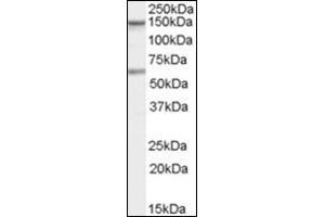 Antibody staining (1 µg/ml) of human Jurkat cells (RIPA buffer, 35 µg total protein per lane). (CARD11 Antikörper  (C-Term))