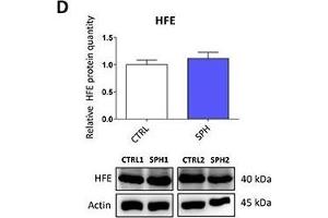 Iron export machinery-related hephaestin (HEPH) and the hemochromatosis gene (HFE) related to systemic iron loading are elevated at the mRNA level but not on the protein level in tumor-initiating cells (TICs)Expression of the HEPH gene at the mRNA level in breast non-malignant cell line MCF10A, in TICs derived from breast cancer cell lines MCF-7, BT-474, T-47D and ZR-75-30 as well as from prostate cancer cell lines DU-145 and LNCaP has been determined (A) together with protein levels in the MCF-7 cell line (CTRL) and MCF-7 derived spheres (SPH) (B). (HFE Antikörper  (AA 262-348))