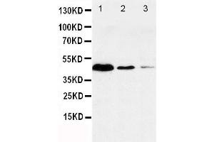 Anti-Caspase-1(P20) antibody, Western blotting Lane 1: JURKAT Cell Lysate Lane 2: RAJI Cell Lysate Lane 3: CEM Cell Lysate (Caspase 1 Antikörper  (N-Term))