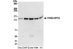 anti-PAN2 Poly(A) Specific Ribonuclease Subunit Homolog (PAN2) (AA 1-50) antibody