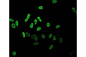 Immunofluorescence (IF) image for anti-Histone Cluster 1, H2ag (HIST1H2AG) (acLys36) antibody (ABIN7139178)