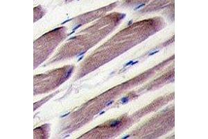 IHC analysis of FFPE human skeletal muscle tissue stained with LATS2 antibody (LATS2 Antikörper  (AA 228-258))