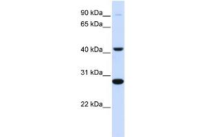 WB Suggested Anti-CYB561 Antibody Titration:  0. (CYB561 Antikörper  (Middle Region))