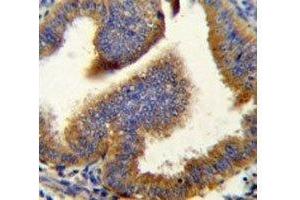 Cyclin B1 antibody immunohistochemistry analysis in formalin fixed and paraffin embedded human uterus tissue. (Cyclin B1 Antikörper  (AA 381-411))