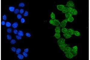 IF analysis of Ikaros using anti-Ikaros2 antibody (ABIN3043860). (IKZF1 Antikörper  (C-Term))