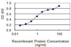 Detection limit for recombinant GST tagged FLJ35767 is 0. (FLJ35767 (AA 1-164) Antikörper)