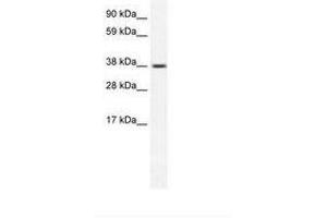 Image no. 1 for anti-Transient Receptor Potential Cation Channel, Subfamily M, Member 3 (TRPM3) (AA 201-250) antibody (ABIN202244) (TRPM3 Antikörper  (AA 201-250))