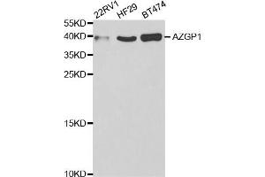 Western Blotting (WB) image for anti-alpha-2-Glycoprotein 1, Zinc-Binding (AZGP1) antibody (ABIN1876553) (AZGP1 Antikörper)