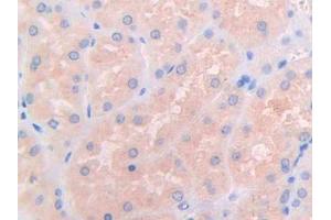 DAB staining on IHC-P; Samples: Human Kidney Tissue (IL3RA Antikörper  (AA 19-158))