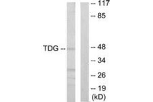 Western Blotting (WB) image for anti-Thymine-DNA Glycosylase (TDG) (AA 31-80) antibody (ABIN2889581) (TDG Antikörper  (AA 31-80))