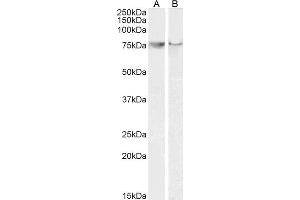 Western Blotting (WB) image for anti-Prostaglandin-Endoperoxide Synthase 2 (Prostaglandin G/H Synthase and Cyclooxygenase) (PTGS2) (C-Term) antibody (ABIN184672)