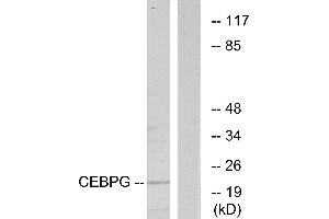Immunohistochemistry analysis of paraffin-embedded human heart tissue using CEBPG antibody. (CEBPG Antikörper)