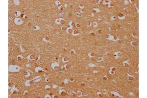 IHC image of ABIN7165095 diluted at 1:100 and staining in paraffin-embedded human brain tissue performed on a Leica BondTM system.