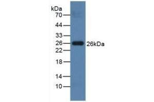 Detection of PRSS2 in Mouse Testis lysate using Polyclonal Antibody to Protease, Serine 2 (PRSS2) (PRSS2 Antikörper  (AA 29-240))