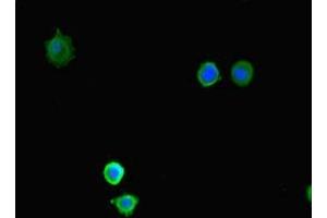 Immunofluorescent analysis of MCF-7 cells using ABIN7158695 at dilution of 1:100 and Alexa Fluor 488-congugated AffiniPure Goat Anti-Rabbit IgG(H+L)