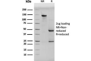 SDS-PAGE Analysis Purified Pan-Cytokeratin Mouse Monoclonal Antibody (PCK/3150). (KRT Antikörper)