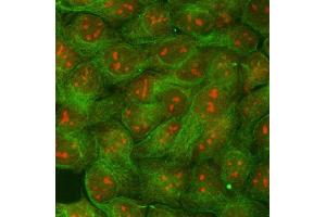 IF analysis of RRP1B and Tubulin beta using anti-RRP1B antibody (ABIN7600561) and anti-Tubulin beta antibody (ABIN7602744). (RRP1B Antikörper  (AA 20-727))
