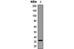 Western blot analysis of MYF5 expression in Jurkat (A) whole cell lysates. (MYF5 Antikörper  (Center))