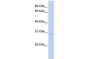 Western Blotting (WB) image for anti-Nuclear Receptor Subfamily 0, Group B, Member 2 (NR0B2) (C-Term) antibody (ABIN2774986)