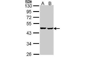 WB Image Sample (30 ug of whole cell lysate) A: Hep G2 , B: Molt-4 , 10% SDS PAGE antibody diluted at 1:1000 (SUCLA2 Antikörper)