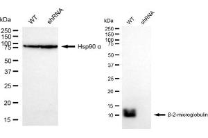 Western blotting analysis using beta 2 Microglobulin antibody (ABIN7797763). (Rekombinanter beta-2 Microglobulin Antikörper)
