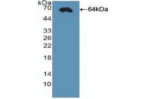Western blot analysis of recombinant Human CDX2. (CDX2 Antikörper  (AA 1-313))