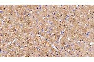 Detection of MOG in Mouse Spinal cord Tissue using Polyclonal Antibody to Myelin Oligodendrocyte Glycoprotein (MOG)