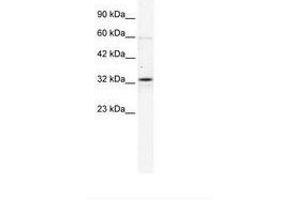 Image no. 2 for anti-Gap Junction Protein, beta 1, 32kDa (GJB1) (C-Term) antibody (ABIN202156) (GJB1 Antikörper  (C-Term))