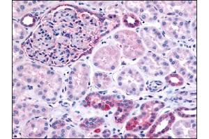 Image no. 1 for anti-Inositol Polyphosphate-5-Phosphatase J (INPP5J) (N-Term) antibody (ABIN302425) (INPP5J Antikörper  (N-Term))