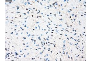 Immunohistochemical staining of paraffin-embedded Ovary tissue using anti-ZFP36 mouse monoclonal antibody. (ZFP36 Antikörper)