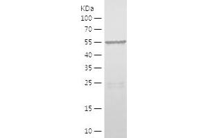 Western Blotting (WB) image for Peroxisomal Biogenesis Factor 5 (PEX5) (AA 94-270) protein (His-IF2DI Tag) (ABIN7124372) (PEX5 Protein (AA 94-270) (His-IF2DI Tag))