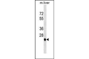 Western blot analysis using SGCD Antibody (C-term) Cat. (SGCD Antikörper  (C-Term))