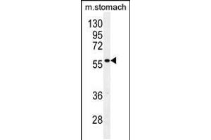 Western blot analysis in mouse stomach tissue lysates (35ug/lane). (Glypican 3 Antikörper  (N-Term))