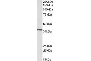 Western Blotting (WB) image for anti-Prostaglandin Reductase 2 (PTGR2) (Internal Region) antibody (ABIN5539654)