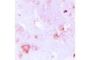 Immunohistochemical analysis of ALDOC staining in human brain formalin fixed paraffin embedded tissue section. (ALDOC Antikörper  (Center))